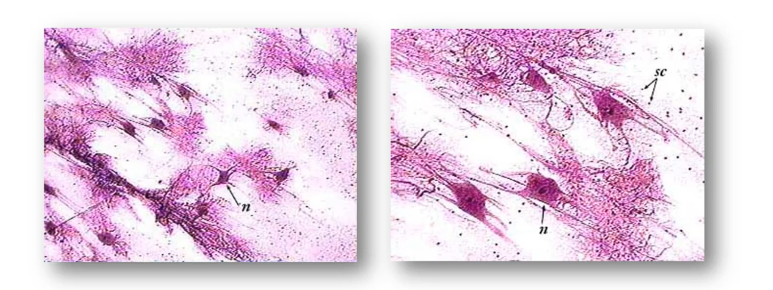 The Neuron